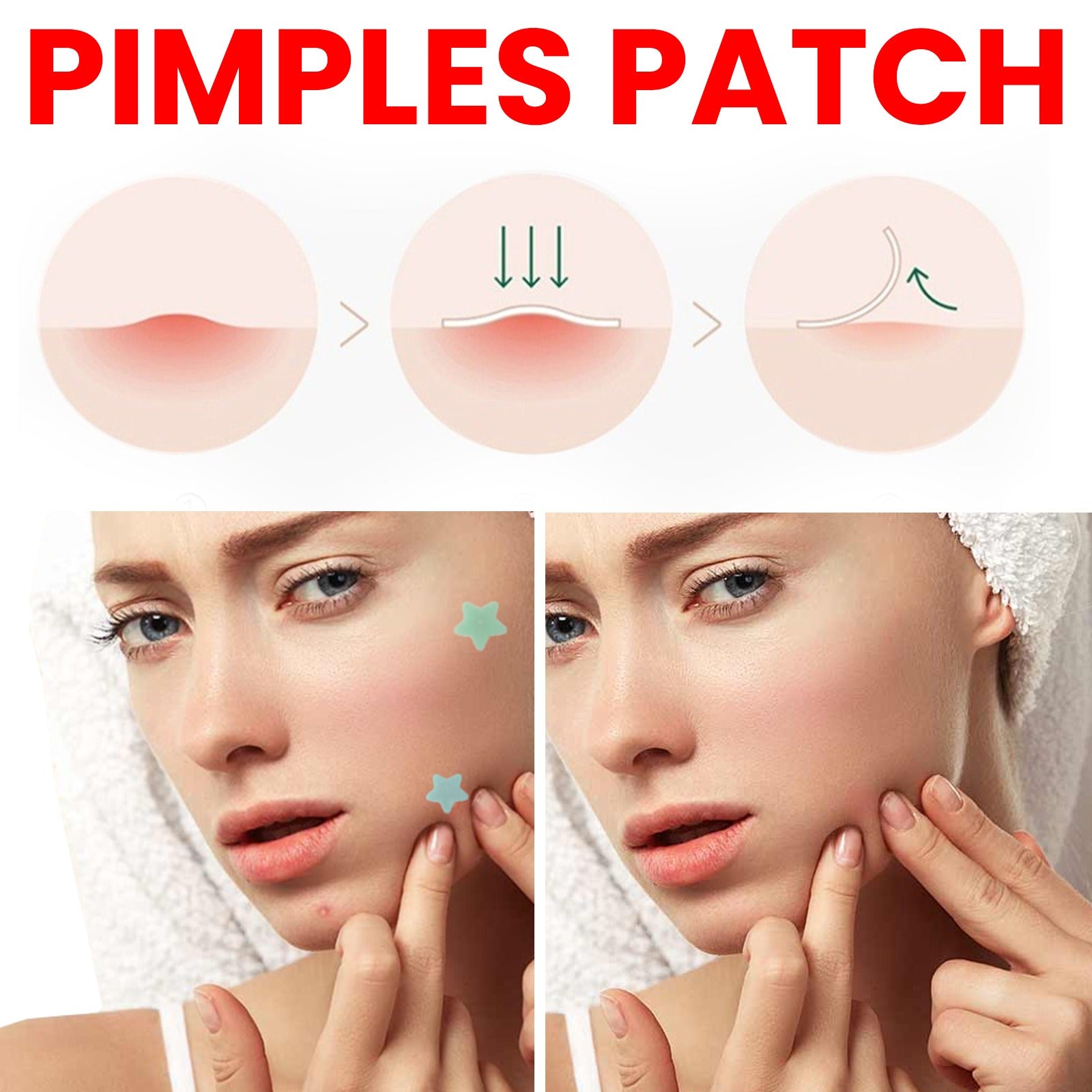 Jaysuing Repair Acne Patch – Fast & Invisible Blemish Care