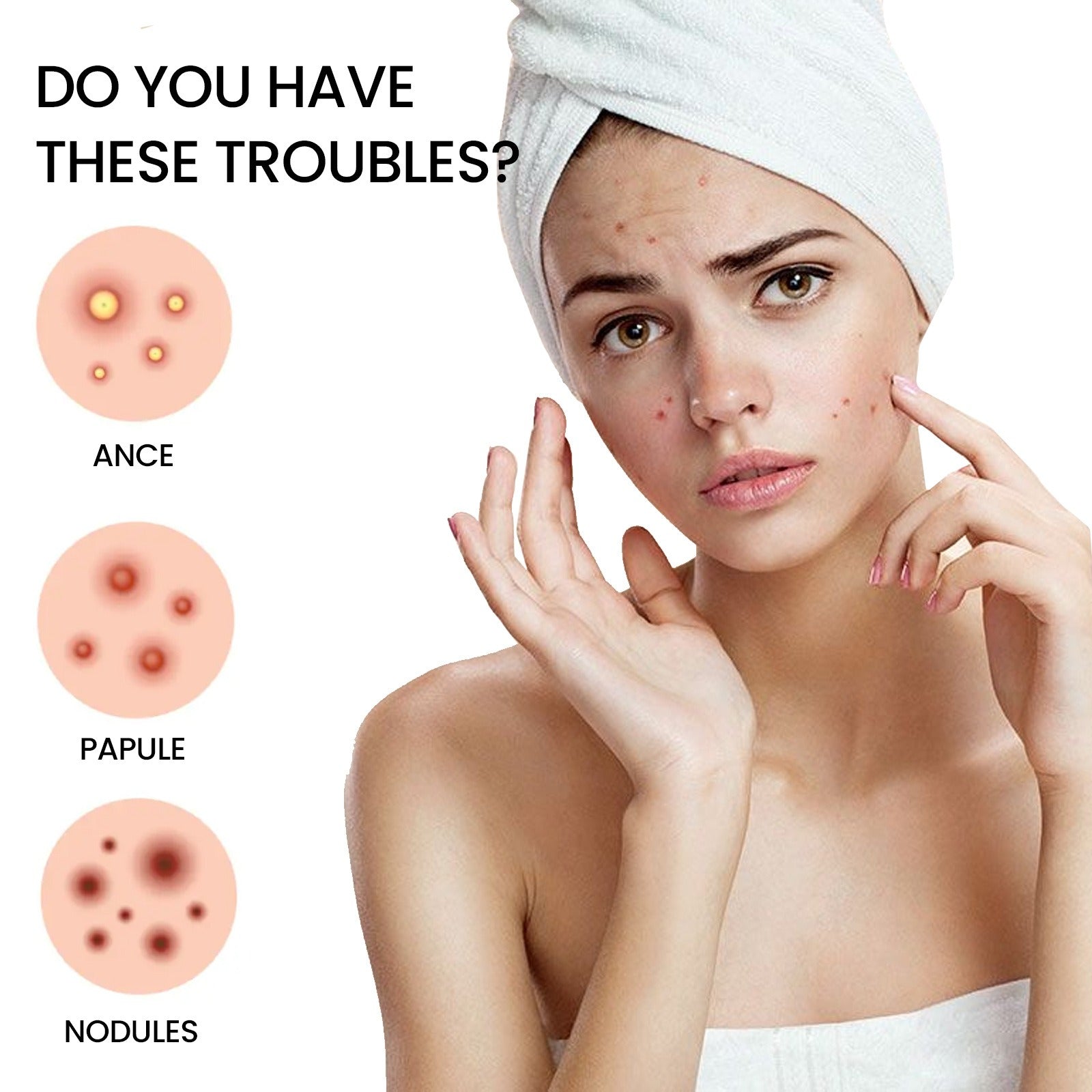 Jaysuing Repair Acne Patch – Fast & Invisible Blemish Care