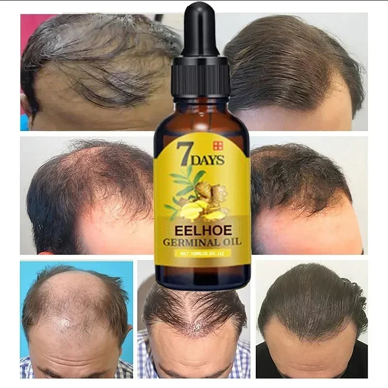 Ginger Growth Hair Treatment Anti Hair Loss Men Women Scalp Treatment Serum