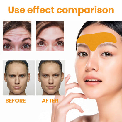 Anti-Aging Collagen Gel Patch - 10pcs